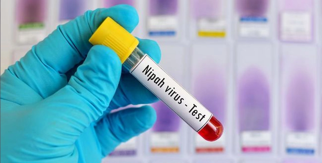 Apa Itu Virus Nipah? Ini Asal Mula Penyebarannya!